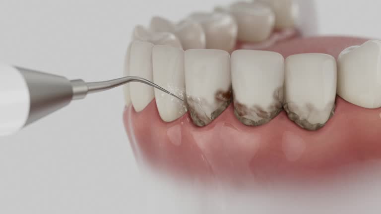 Reliable Emergency Dentist contractor in McQueeney, TX by Smile Center Dentistry